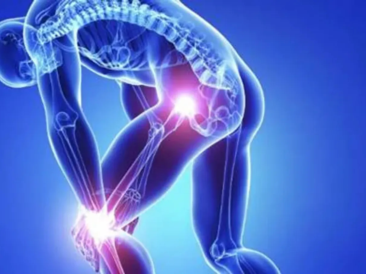 Síndrome de Guillain-Barré: doença rara pode levar à paralisia e exige reabilitação intensiva